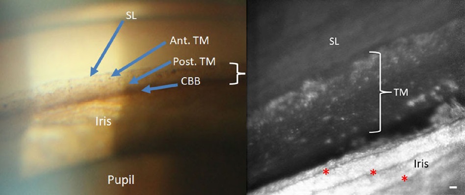 imágenes microscópicas sin distorsiones de una parte del ojo involucrada en el glaucoma